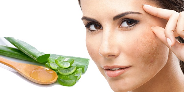 10 Cách Trị Nám Da Mặt Bằng Thiên Nhiên Hiệu Quả Tại Nhà